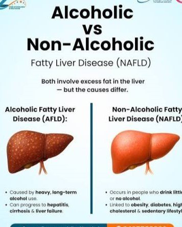 11. Fatty Liver Disease (NAFLD) or Elevated Liver Enzymes