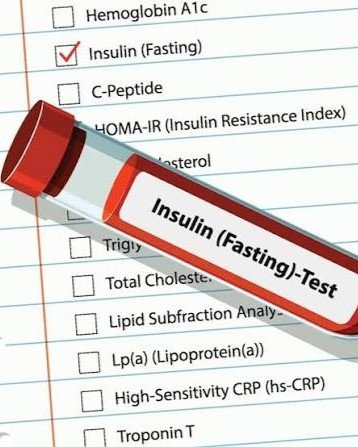 3. Elevated Fasting Glucose, A1c, or Fasting Insulin (Prediabetes)