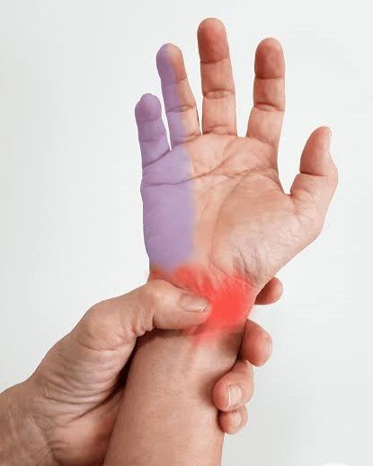 6. Numbness, Tingling, or Pins and Needles