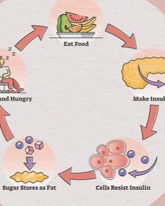 How Insulin Resistance Develops