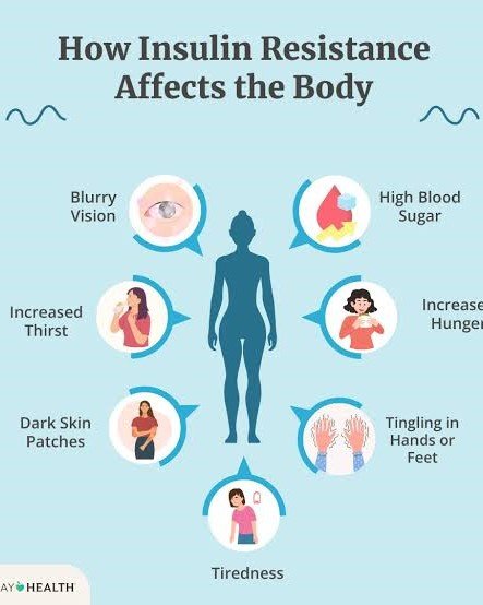 What Is Insulin Resistance? (Brief Explainer)