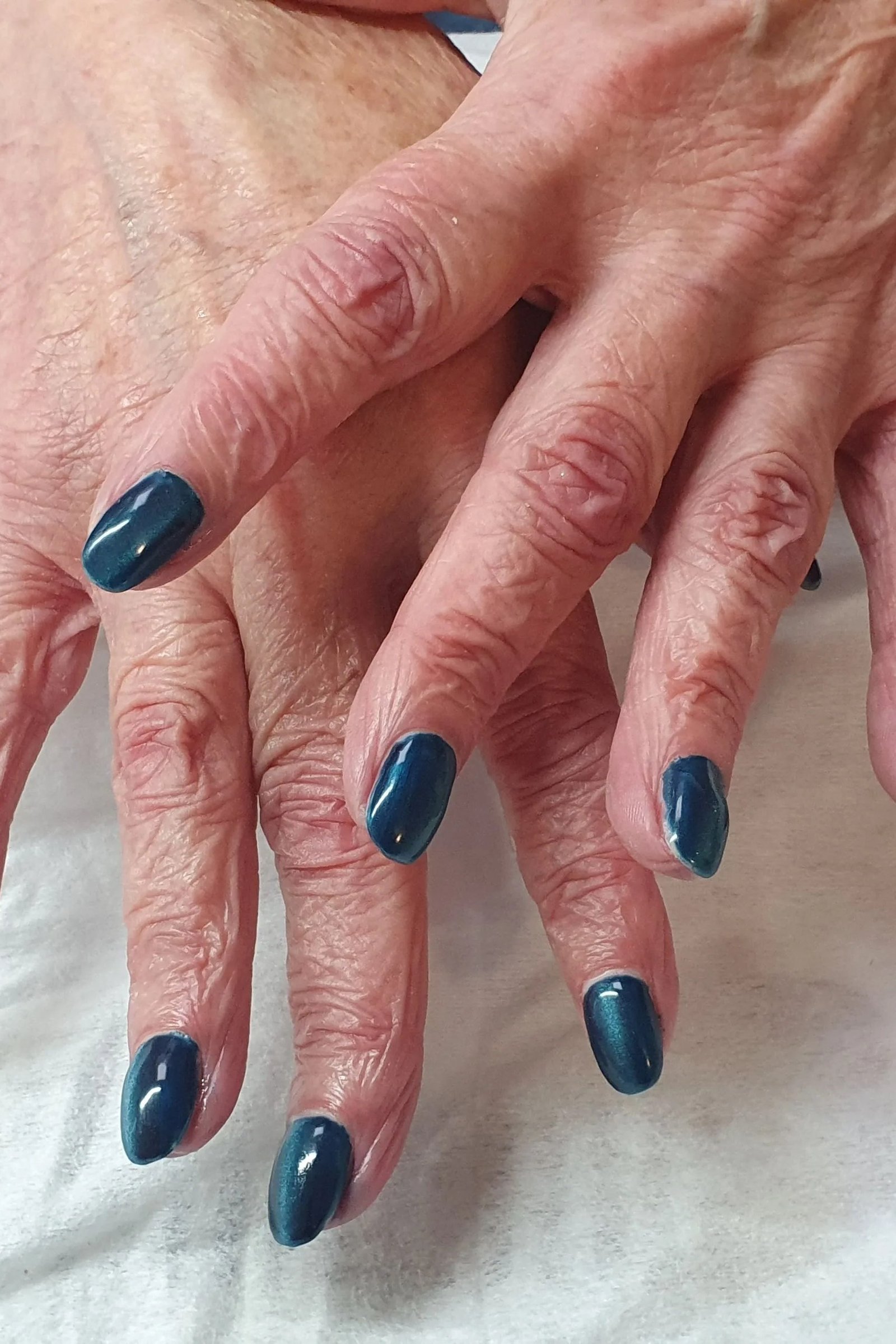 Deep Teal Cat Eye Nails - Dark teal polish with a magnetic light streak covers these short, squoval nails.