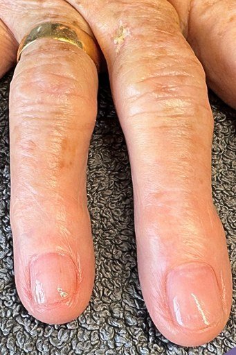 Healthy bare natural nails on a mature hand with gold ring