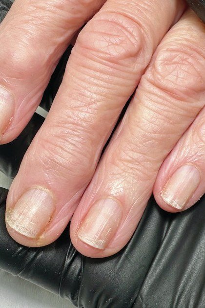 Close-up of mature hand showing natural nail texture after 50