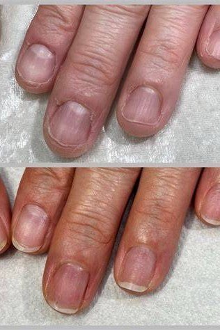Before and after nail care results on mature hands