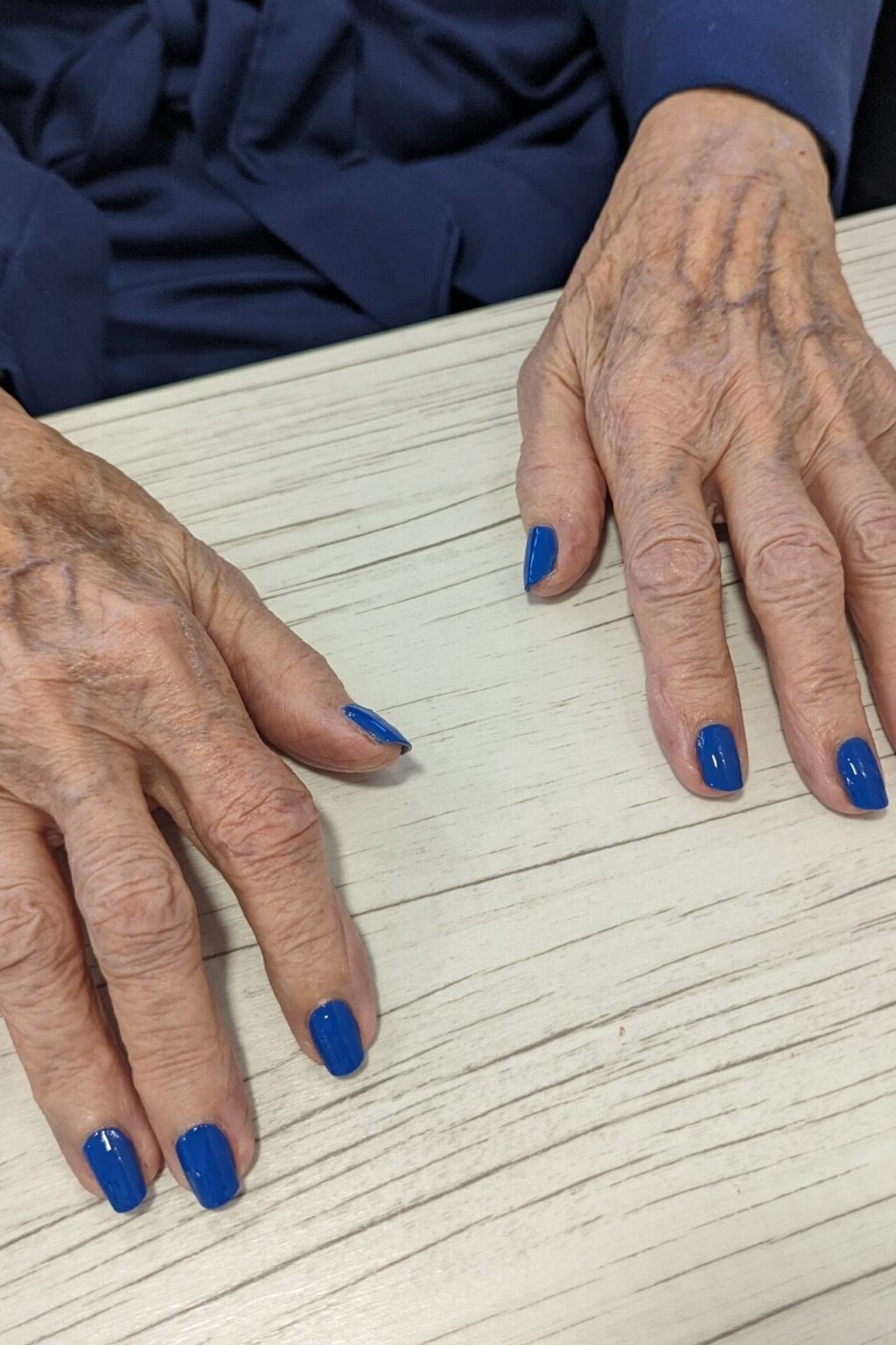 bright blue short nails on aged hands