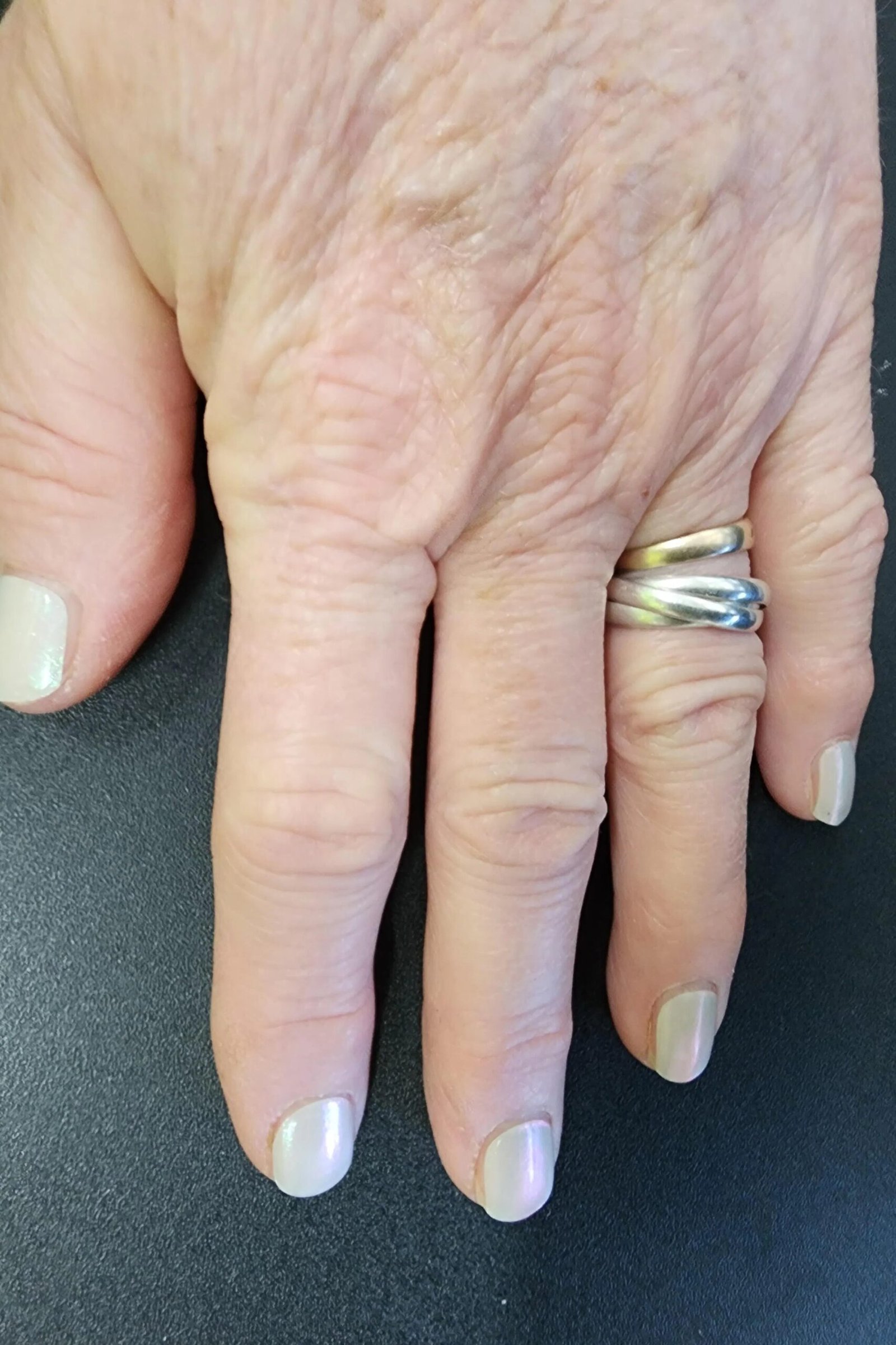 Pearly white oval nails on elderly hand with silver rings for women over 70