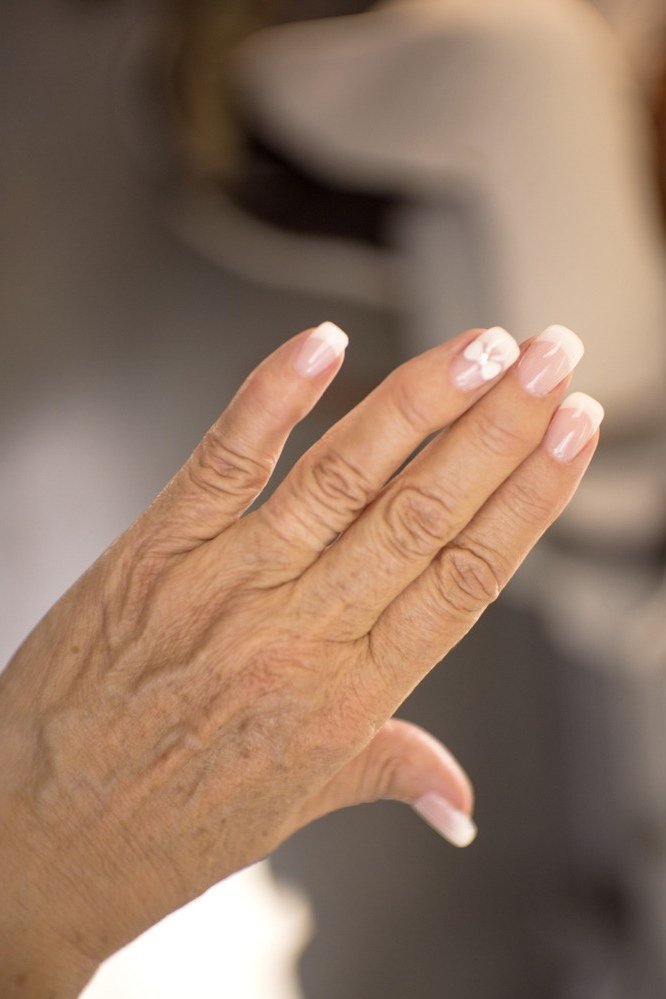 Side view of milky white nails on an older hand