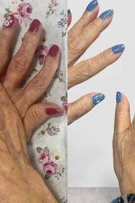 blue and red before-after on mature hands