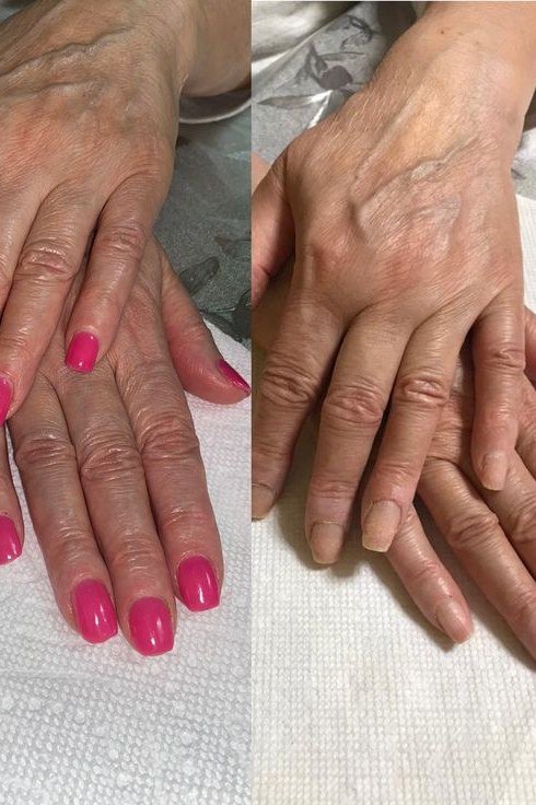 hot pink manicure before and after aged hands