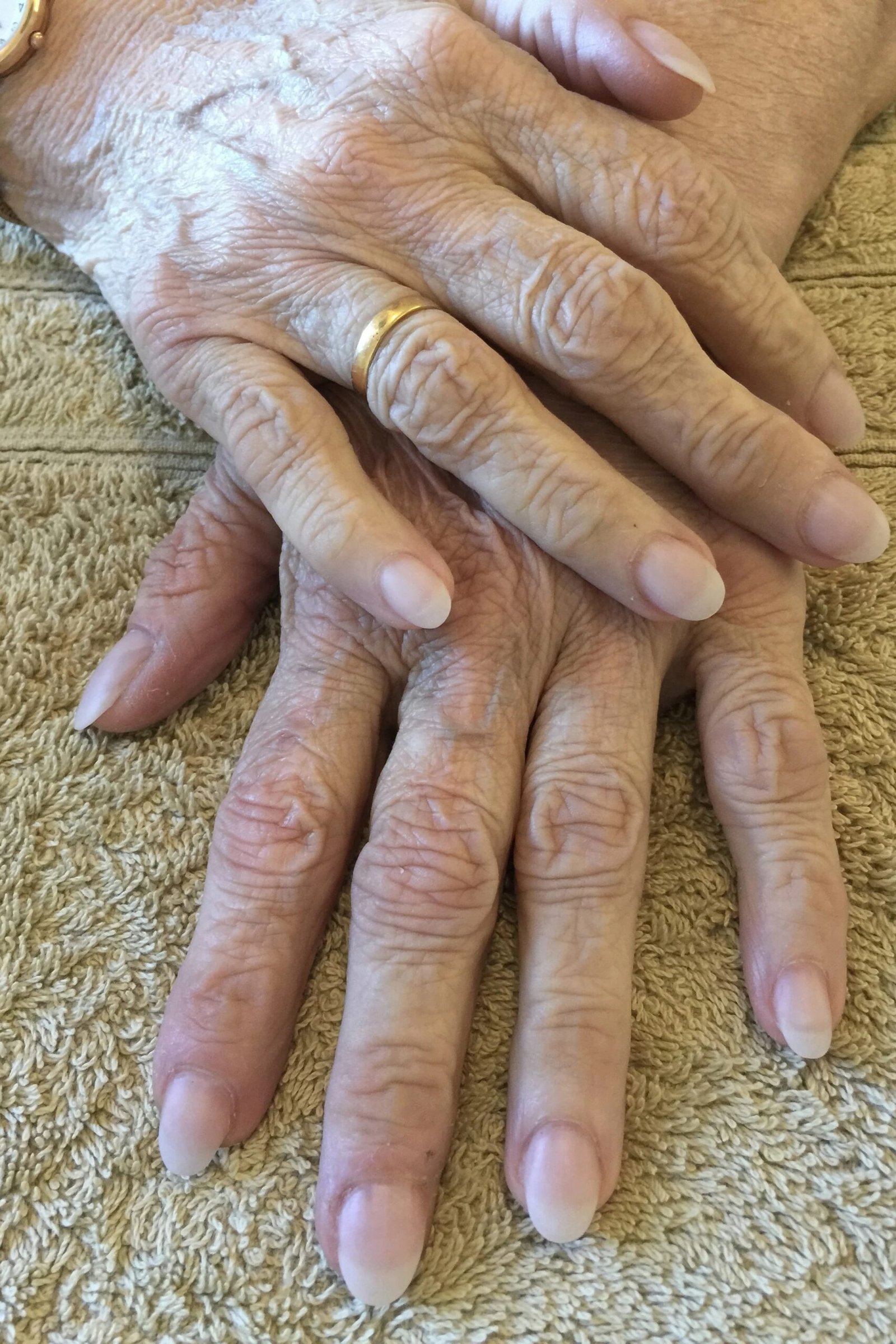 Patting mature hands dry gently with a soft towel