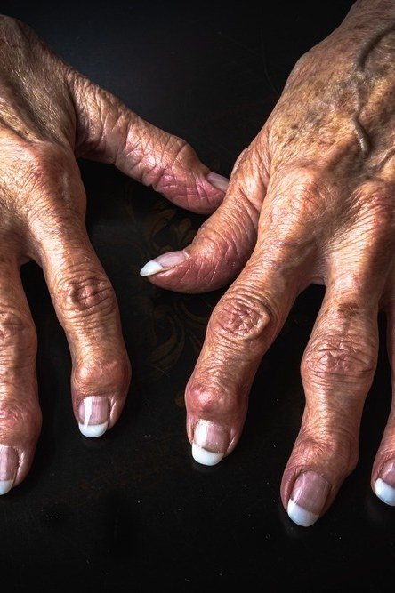 Nude French Tips on Dark Background - winter nail trend for older women over 70