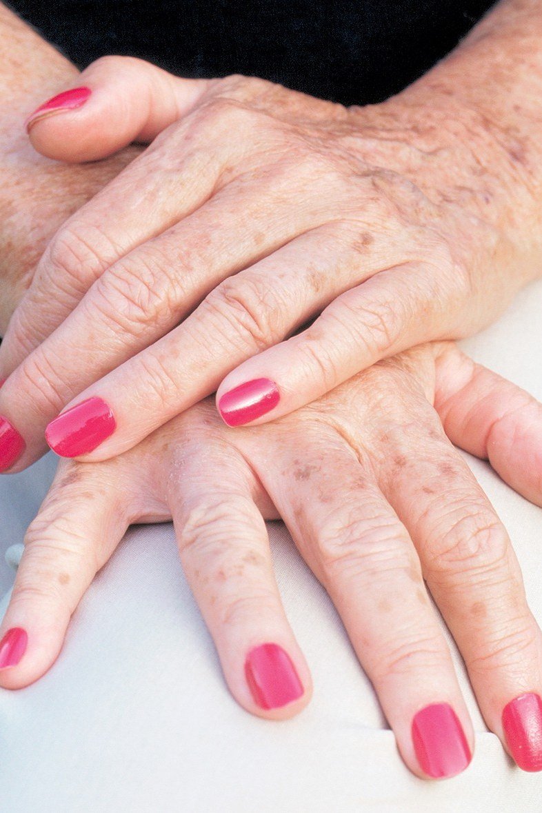 Bright Pink Tip Nails - flattering nail color for women over 70 on mature hands
