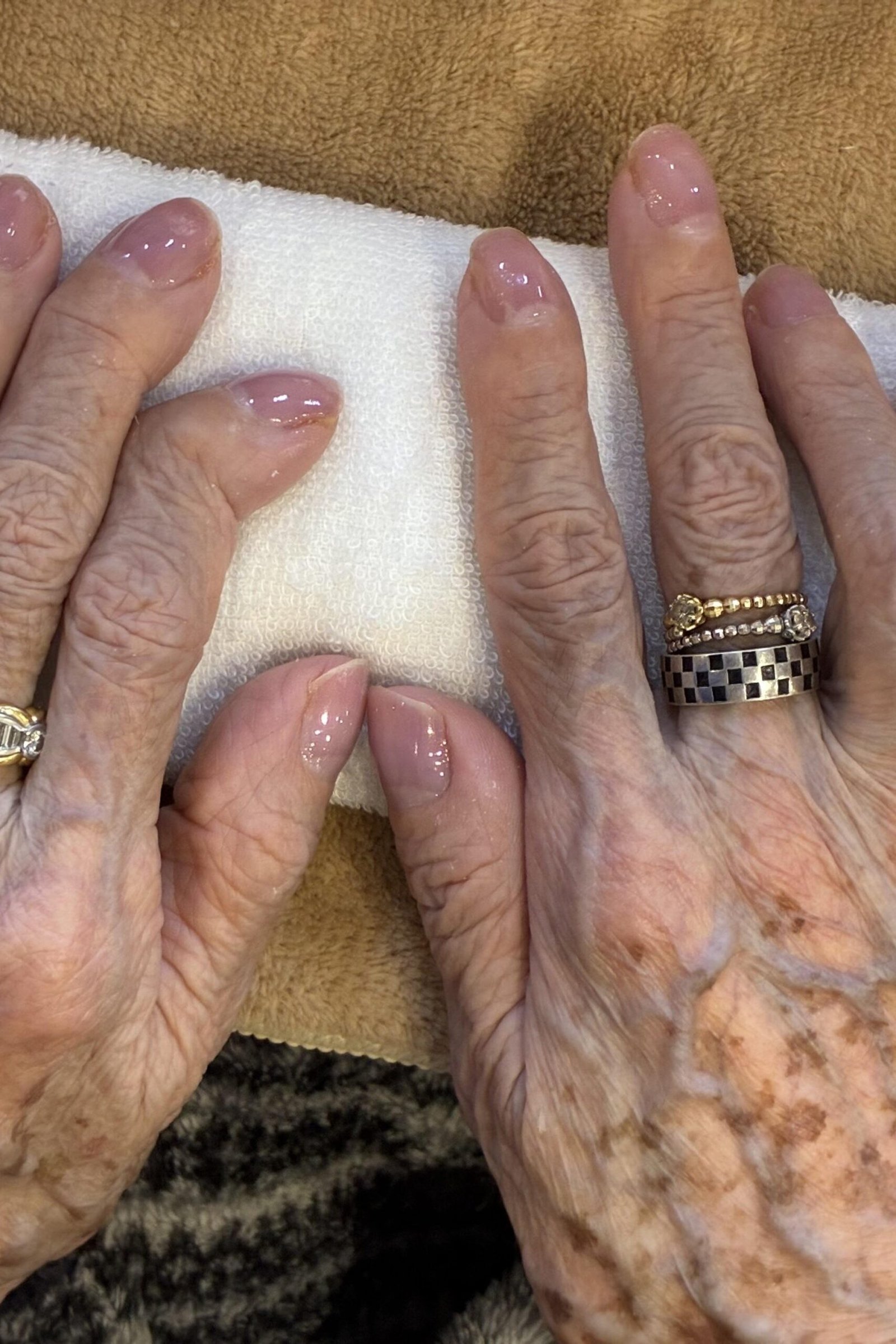 Natural nails on very aged hands with rings on a white towel - simple natural nail idea for women over 60