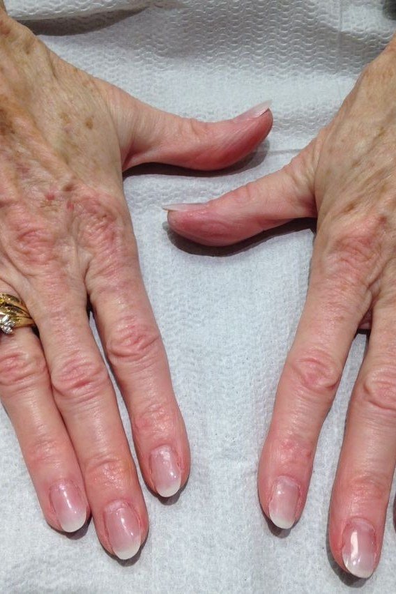 Natural pink nails on two aged hands laid flat - simple natural nail idea for women over 60
