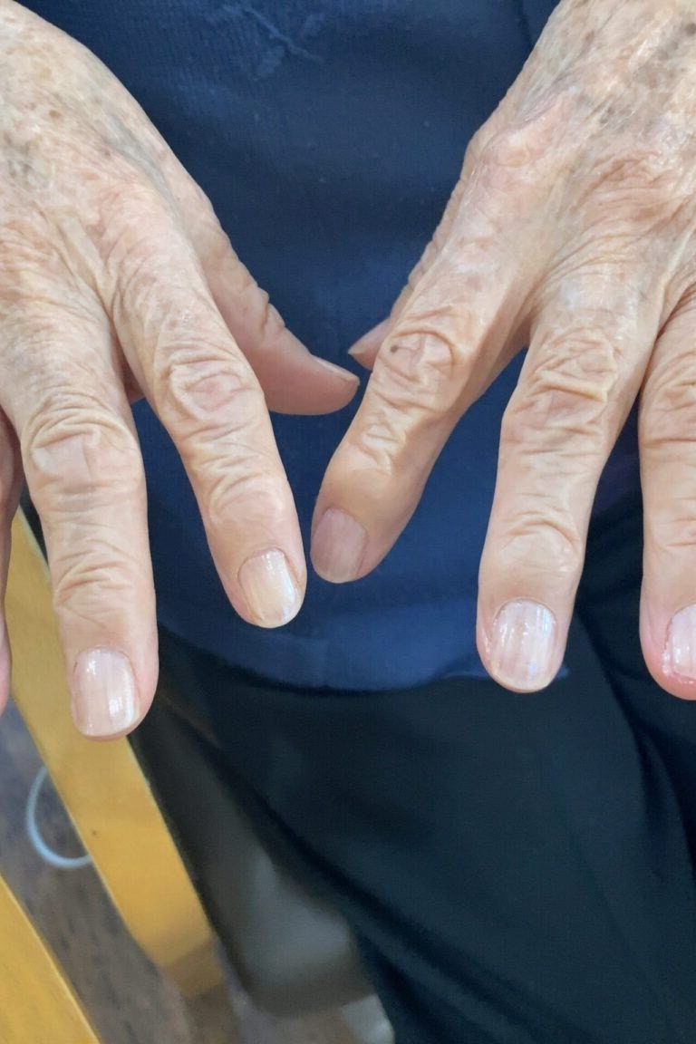 Natural nails on two aged hands spread on a lap - simple natural nail idea for women over 60