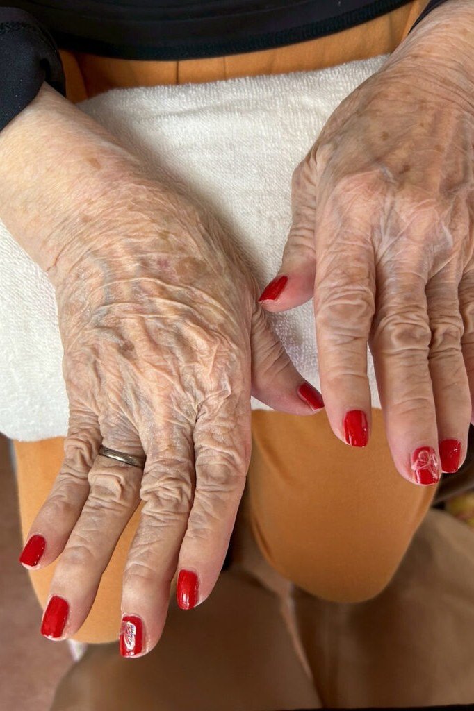 Classic Red on Mature Hands for women over 60 - simple nail tip 21