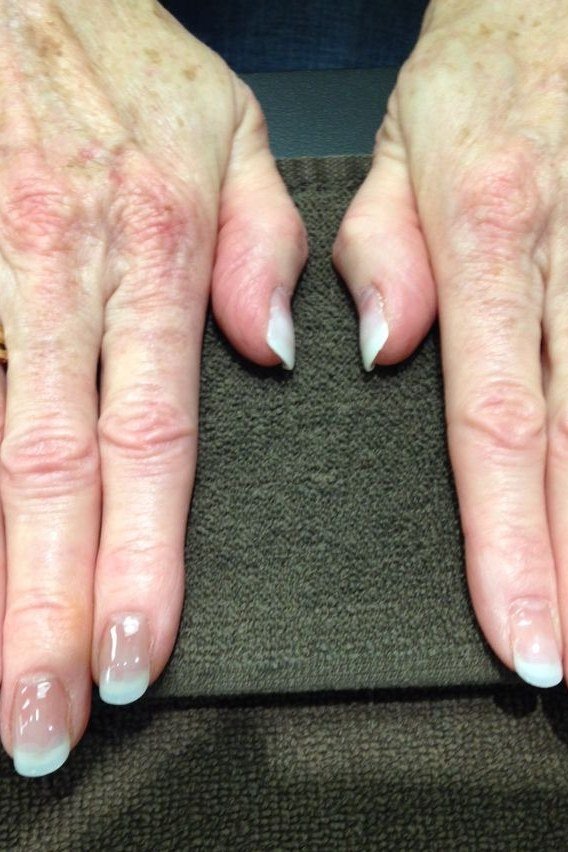 White French on Aged Hands, winter nail color idea for women over 60